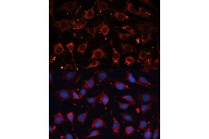 Immunofluorescence analysis of C6 cells using CASP3 antibody. (Caspase 3 抗体  (AA 55-160))