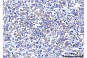 IHC analysis of RPS5 using anti-RPS5 antibody (ABIN7599076).