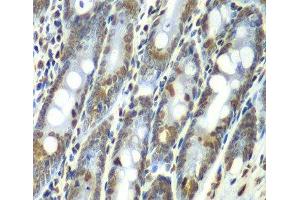 Immunohistochemistry of paraffin-embedded Rat Intestine using SEPT7 Polyclonal Antibody at dilution of 1:100 (40x lens). (Septin 7 抗体)