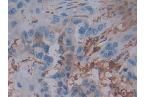 Immunohistochemistry (IHC) image for anti-Ferritin, Light Polypeptide (FTL) (AA 2-175) antibody (ABIN7435310)