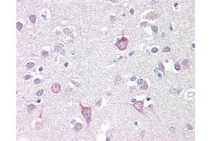 Anti-AP3B2 antibody IHC staining of human brain, cortex. (AP3B2 抗体  (N-Term))