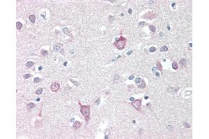 Anti-AP3B2 antibody IHC staining of human brain, cortex.