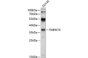 Western blot analysis of extracts of DU145 cells, using TMEM74 antibody (ABIN6131065, ABIN6149271, ABIN6149272 and ABIN6214614) at 1:1000 dilution. (TMEM74 抗体  (AA 1-180))