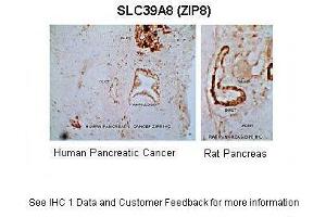 Immunohistochemistry (IHC) image for anti-Solute Carrier Family 39 (Zinc Transporter), Member 8 (SLC39A8) (N-Term) antibody (ABIN2781682)