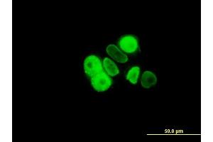 Immunofluorescence of monoclonal antibody to PGR on MCF-7 cell. (Progesterone Receptor 抗体  (AA 1-110))