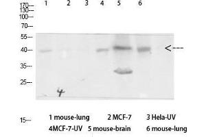 Western Blot (WB) analysis of specific cells using Antibody diluted at 1:1000. (beta Arrestin 1 抗体  (Ser157))
