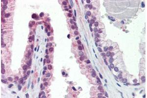 Human Prostate (formalin-fixed, paraffin-embedded) stained with TULP2 antibody ABIN462210 followed by biotinylated goat anti-rabbit IgG secondary antibody ABIN481713, alkaline phosphatase-streptavidin and chromogen. (TULP2 抗体  (N-Term))
