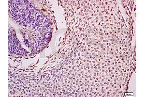 Formalin-fixed and paraffin embedded mouse tooth germ tissue labeled with Anti-Nanog Polyclonal Antibody (ABIN728758), Unconjugated at 1:200, followed by conjugation to the secondary antibody and DAB staining (Nanog 抗体  (AA 71-170))