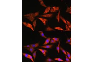 Immunofluorescence analysis of NIH/3T3 cells using ALDOB Rabbit pAb (ABIN1678634, ABIN3018008, ABIN3018009 and ABIN6220333) at dilution of 1:100. (ALDOB 抗体  (AA 1-200))