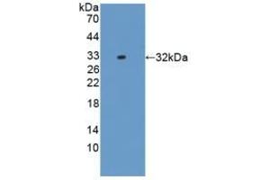 Detection of Recombinant IL17RD, Rat using Polyclonal Antibody to Interleukin 17 Receptor D (IL17RD) (IL17RD 抗体  (AA 356-605))