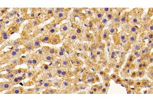 Detection of OT in Mouse Liver Tissue using Polyclonal Antibody to Preprooxytocin (OT) (OXT 抗体  (AA 20-124))