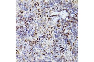 Immunohistochemistry of paraffin-embedded rat spleen using THBS1 Rabbit pAb (ABIN3022978, ABIN3022979, ABIN3022980 and ABIN6219329) at dilution of 1:50 (40x lens). (Thrombospondin 1 抗体  (AA 80-360))