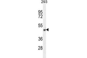 Western Blotting (WB) image for anti-Cochlin (COCH) antibody (ABIN2996145) (COCH 抗体)