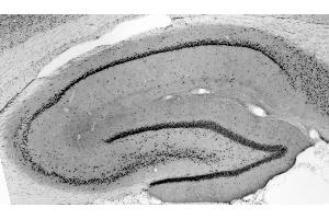 Adult rat hippocampus immunohistochemistry.