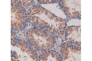 Used in DAB staining on fromalin fixed paraffin- embedded testis tissue (MAPKAP Kinase 2 抗体  (AA 117-337))