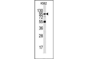 Image no. 1 for anti-Phosphoinositide-3-Kinase, Regulatory Subunit 5 (PIK3R5) (Middle Region) antibody (ABIN360464) (PIK3R5 抗体  (Middle Region))