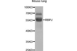 Western blot analysis of extracts of mouse lung, using RBPJ antibody. (RBPJ 抗体)