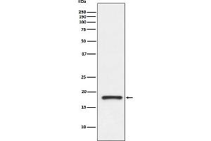 Western blot analysis of Prealbumin gamma expression in human fetal kidney lysate.