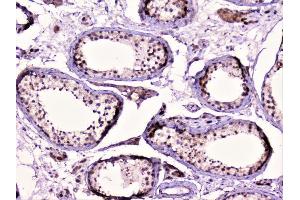 IHC analysis of Rad51 using anti-Rad51 antibody (ABIN6719396).