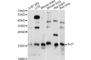 Western blot analysis of extracts of various cell lines, using AVP antibody (ABIN6291780) at 1:1000 dilution. (Vasopressin 抗体)