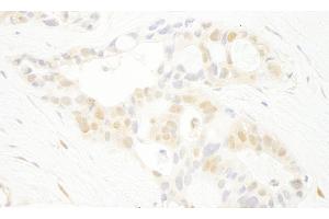 Immunohistochemistry (IHC) image for anti-Serine/threonine-Protein Kinase PRP4 Homolog (PRPF4B) (AA 1-50) antibody (ABIN7448746)