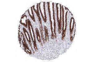 stomach antrum (Recombinant MUC5AC 抗体)
