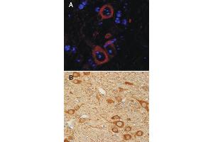 A: Indirect immunostaining of PFA fixed mouse cortex sections (dilution 1 : 5000; red).