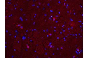 Paraformaldehyde-fixed, paraffin embedded Mouse brain; Antigen retrieval by boiling in sodium citrate buffer (pH6. (MUL1 抗体  (AA 45-95))
