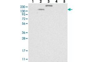 Western blot analysis of Lane 1: RT-4, Lane 2: U-251 MG, Lane 3: Human Plasma, Lane 4: Liver, Lane 5: Tonsil with TTC21B polyclonal antibody . (TTC21B 抗体)