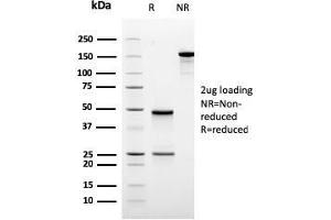 SDS-PAGE Analysis Purified ODC-1 Recombinant Mouse Monoclonal Antibody (rODC1/485). (Recombinant ODC1 抗体)