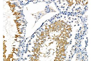 ABIN6262069 and ABIN6276964 at 1/100 staining Rat testis tissue by IHC-P. (GPX4 抗体  (C-Term))