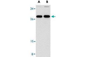 Western blot analysis of PPPDE1 in EL4 cell lysate with PPPDE1 polyclonal antibody  at (A) 1 and (B) 2 ug/mL . (PPPDE1 抗体  (C-Term))