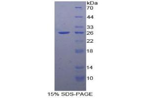 SDS-PAGE analysis of Human FADD Protein. (FADD 蛋白)