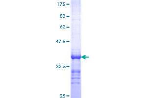 Image no. 1 for Parathyroid Hormone (PTH) (AA 32-115) protein (GST tag) (ABIN1316769)