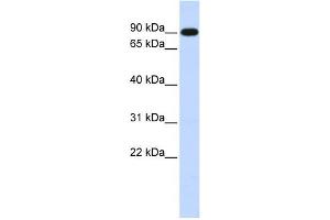 WB Suggested Anti-ZXDA Antibody Titration:  0. (ZXDA 抗体  (Middle Region))
