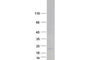 MRPL11 Protein (Transcript Variant 2) (Myc-DYKDDDDK Tag)