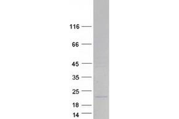 MRPL11 Protein (Transcript Variant 2) (Myc-DYKDDDDK Tag)