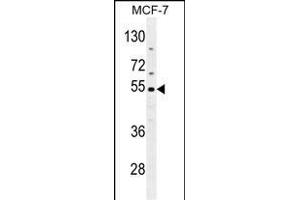 CES2 Antibody (Center) (ABIN654618 and ABIN2844316) western blot analysis in MCF-7 cell line lysates (35 μg/lane). (CES2 抗体  (AA 340-369))