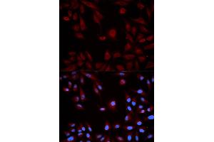 Immunofluorescence analysis of HeLa cells using STAT5B antibody. (STAT5B 抗体)