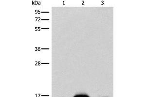 Western blot analysis of Mouse heart tissue Human heart tissue Human muscle tissue lysates using COX6A2 Polyclonal Antibody at dilution of 1:400 (COX6A2 抗体)