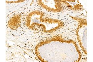 ABIN6259941 and ABIN6273031 at 1/100 staining Human normal tissues adjacent to breast cancer by IHC-P. (Annexin VII 抗体  (N-Term))