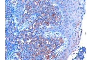 ABIN185362 (3µg/ml) staining of paraffin embedded Human Tonsil. (MYD88 抗体  (Internal Region))