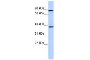 Image no. 1 for anti-DEAH (Asp-Glu-Ala-His) Box Polypeptide 35 (DHX35) (N-Term) antibody (ABIN6740494) (DHX35 抗体  (N-Term))