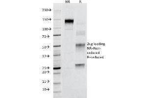 SDS-PAGE Analysis Purified CD95 Mouse Monoclonal Antibody (B-R18). (FAS 抗体)