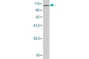 Western Blot detection against Immunogen (85. (CHEK2 抗体  (AA 1-543))
