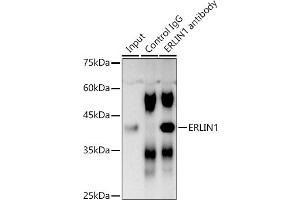 Immunoprecipitation analysis of 300 μg extracts of DU145 cells using 3 μg ERLIN1 antibody (ABIN7267005). (ERLIN1 抗体  (AA 259-348))