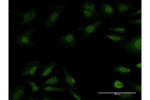 Immunofluorescence of purified MaxPab antibody to PSMB7 on HeLa cell. (PSMB7 抗体  (AA 1-277))