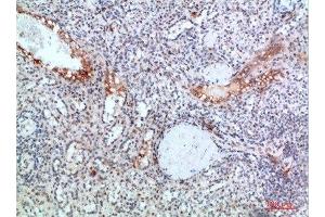 Immunohistochemical analysis of paraffin-embedded human-spleen, antibody was diluted at 1:200 (TICAM1 抗体  (AA 663-712))