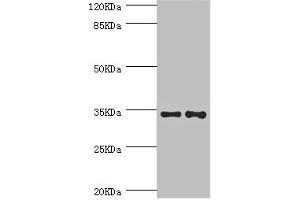 Western blot All lanes: NRBF2 antibody at 5. (NRBF2 抗体  (AA 10-220))