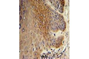 Immunohistochemistry (Paraffin-embedded Sections) (IHC (p)) image for anti-Collagen, Type XVII, alpha 1 (COL17A1) (Chain alpha 1), (Middle Region) antibody (ABIN951629)